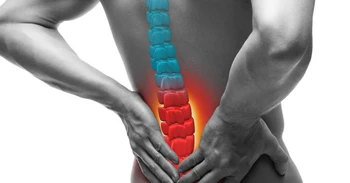 شکستگی مهره‌های کمر